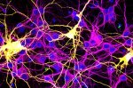 Could fused neurons explain COVID-19’s ‘brain fog’?