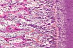 More than red blood cells depend on hemoglobin, surprising study of cartilage reveals