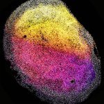 Groundbreaking Research: First Brain Organoids Grown from Fetal Tissue Shed Light on Developmental Mysteries