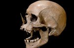 Ancient DNA Unravels Mysteries: Higher Risk of Diseases, Including MS, Linked to Ancestry from Bronze Age Migrations