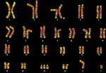 Ancient DNA Unveils Down Syndrome in Infants From 2600 Years Ago