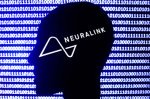 Second brain implant by Elon Musk’s Neuralink: will it fare better than the first?