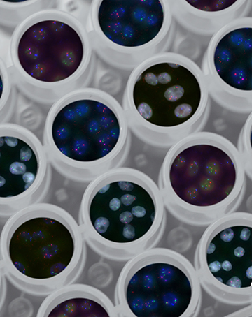 A solution for secure analysis of genetic data developed in Estonia