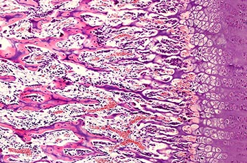 More than red blood cells depend on hemoglobin, surprising study of cartilage reveals