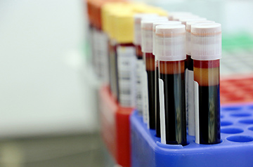Balancing Regulation and Access: FDA's Bid to Oversee Lab Tests Sparks Controversy