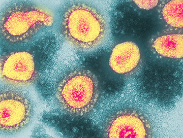 Unveiling the Cold Cousins of COVID: Exploring the History and Evolution of Human Coronaviruses