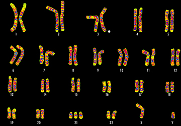 Ancient DNA Unveils Down Syndrome in Infants From 2600 Years Ago