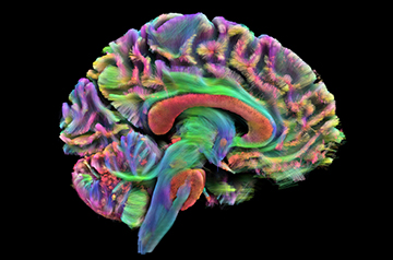 Brain imaging study in children shows sex and gender operate in different networks of the brain