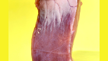 3D-Printable Tissue Adhesive Breakthrough in Biomedical Technology