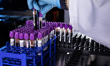 Genetic Adaptation Unveiled: Exploring Papua New Guinea's Unique Evolutionary Journey