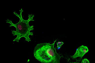 Study Reveals Unique Human Gene Enhancing Immune Function