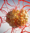 Failed cancer therapy revived as powerful tumor killer when combined with newer drugs