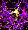 Could fused neurons explain COVID-19’s ‘brain fog’?