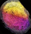 Groundbreaking Research: First Brain Organoids Grown from Fetal Tissue Shed Light on Developmental Mysteries