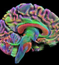 Brain imaging study in children shows sex and gender operate in different networks of the brain
