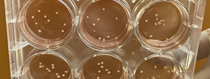 SCIENTISTS GROW MINIATURE BRAINS THAT MIMIC THE MAJOR PATHOLOGICAL FEATURES OF PARKINSON’S DISEASE