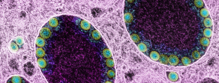 Chinese Researcher Submitted First SARS-CoV-2 Genome to U.S. Database, Sparking Controversy Over Early Disclosure
