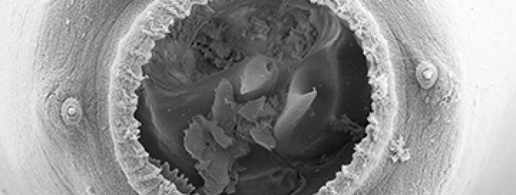 Stress turns tiny worm into a big-mouthed cannibal