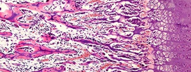 More than red blood cells depend on hemoglobin, surprising study of cartilage reveals