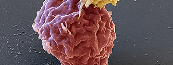FDA Investigates Potential Link Between CAR-T Therapy and Blood Cancer: What We Know So Far