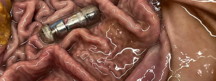 Innovative Vibrating Pill Signals Potential Breakthrough in Weight Loss