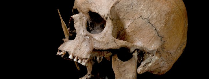 Ancient DNA Unravels Mysteries: Higher Risk of Diseases, Including MS, Linked to Ancestry from Bronze Age Migrations