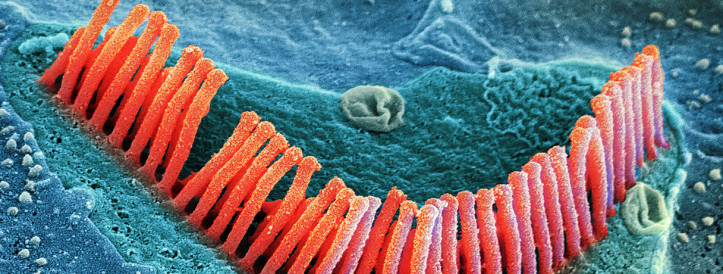 Gene Therapies Show Promise in Restoring Hearing for Deaf Children