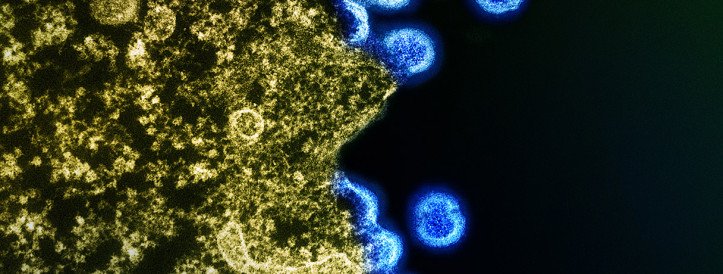 New Study Offers Hope for HIV-Infected Babies, But Cautions Remain