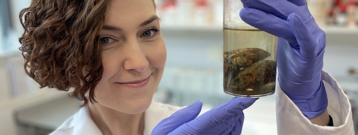 Insights from the Past: Ancient Brains Defy Decay