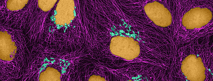 Hundreds of Cancer Papers Mention Nonexistent Cell Lines