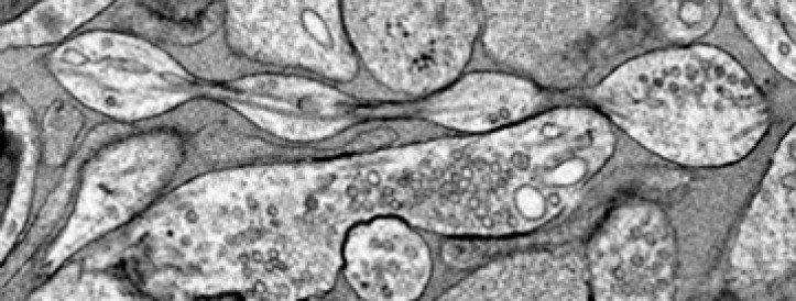 Controversial study redraws classical picture of the neuron