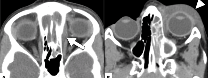 Journal retracts article for plagiarized images after trying to gag researcher who complained