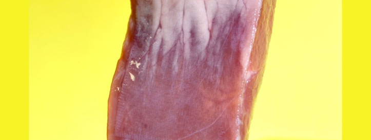 3D-Printable Tissue Adhesive Breakthrough in Biomedical Technology