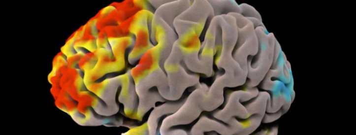 What accelerates brain ageing? This AI ‘brain clock’ points to answers