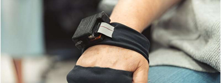 Breakthrough: Vibrating Glove Offers New Hope for Stroke Patients' Muscle Spasms